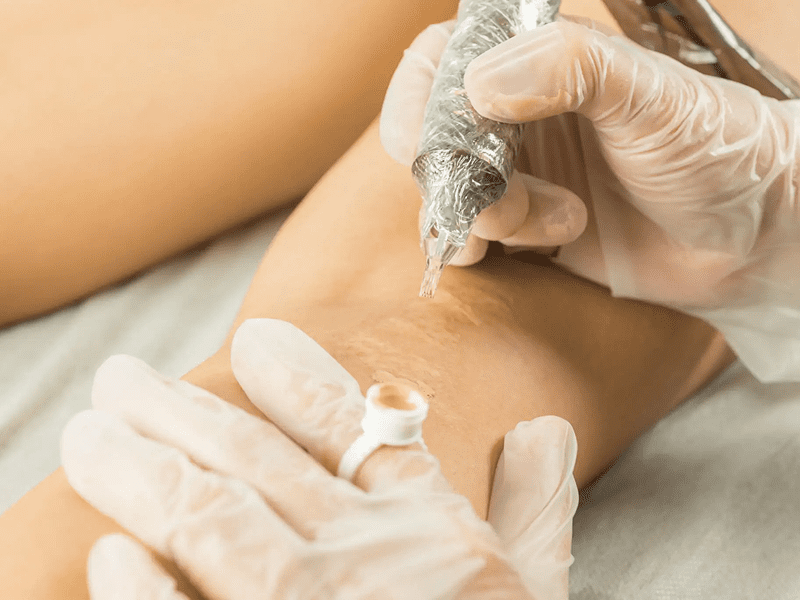 Gloved artist using tattoo machine on arm